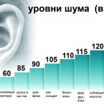 Figure. 2. Niveaux de bruit