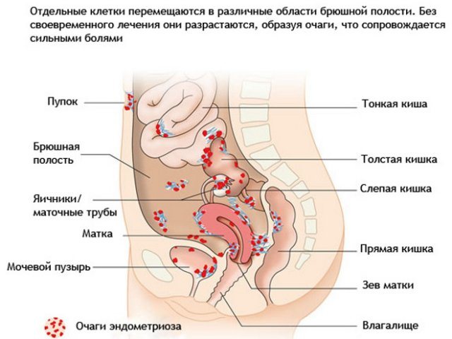 Tire le bas de l'abdomen et fait mal à la poitrine - causes, maladies possibles